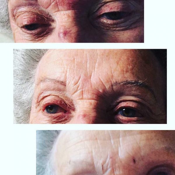 Joanne Walton Permanent Eyebrow Before and After