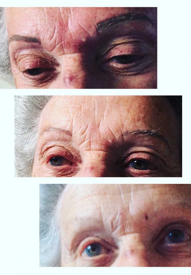 Joanne Walton Permanent Eyebrow Before and After